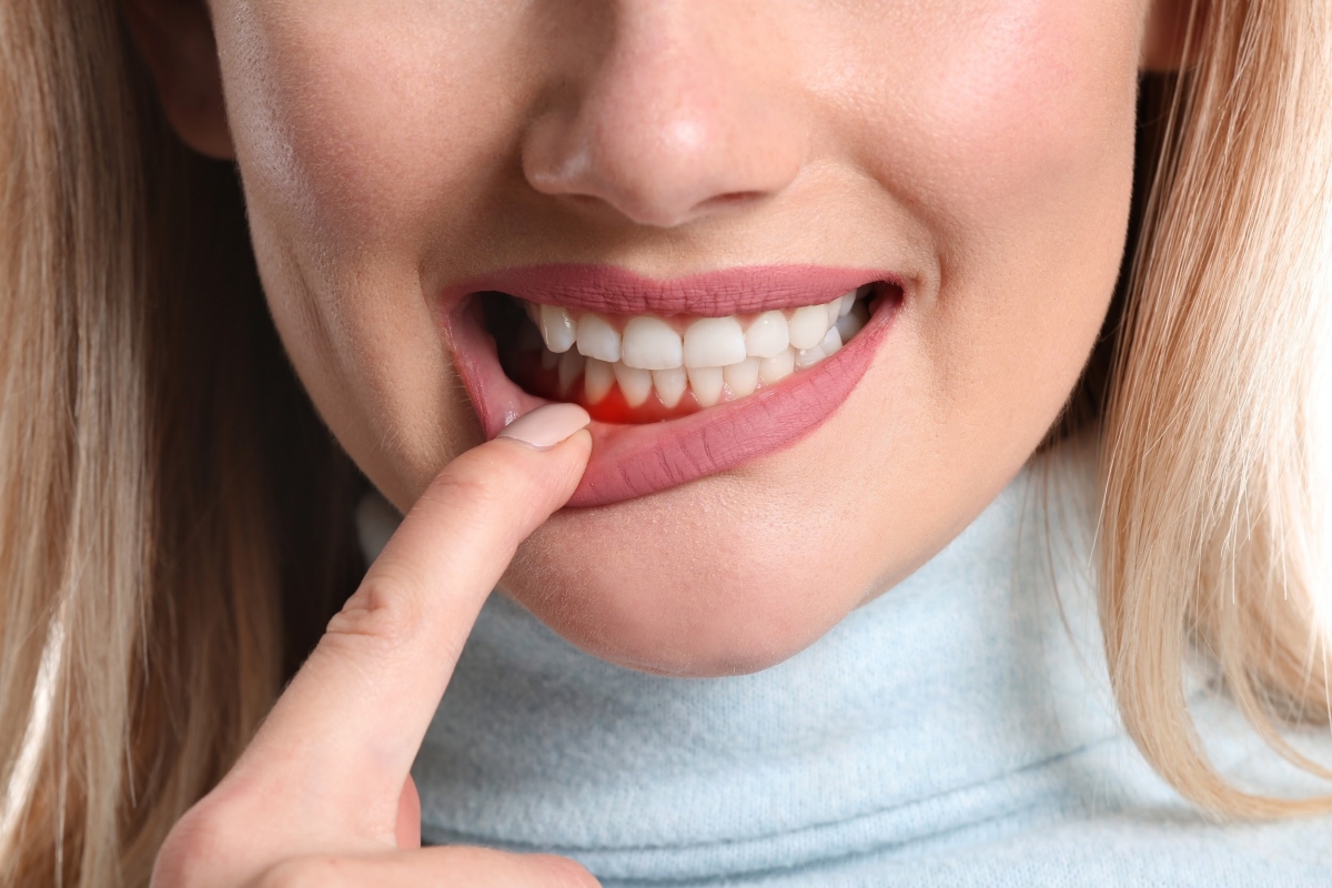 7 hậu quả nghiêm trọng nếu lười đánh răng